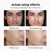 Vitamin C Ampoule Serum Set: Moisturizing & Brightening