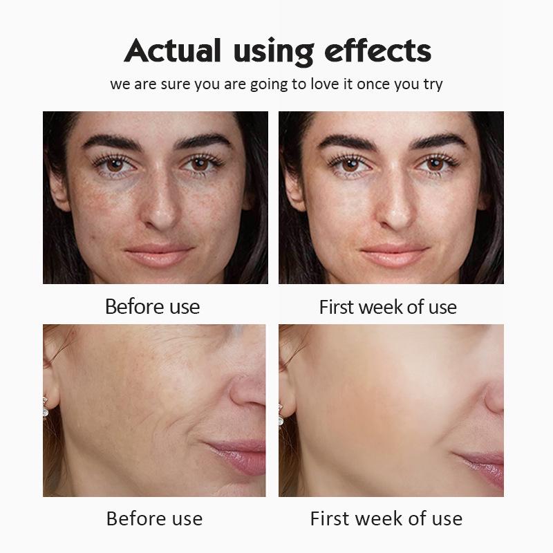 Vitamin C Ampoule Serum Set: Moisturizing & Brightening