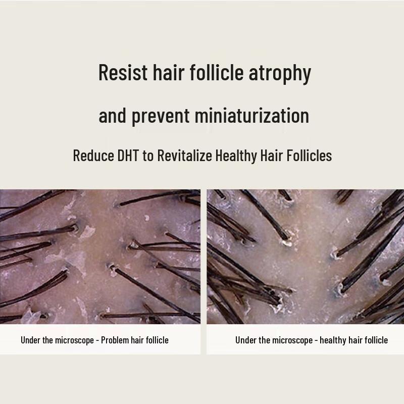 Hathaway Herbal Ginger Anti-Hair Loss & Oil Control Shampoo Twin Pack