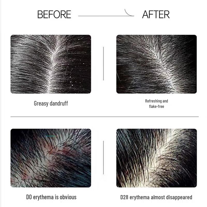 Spes Myrrh Peptide Anti-Dandruff Itch Relief Shampoo