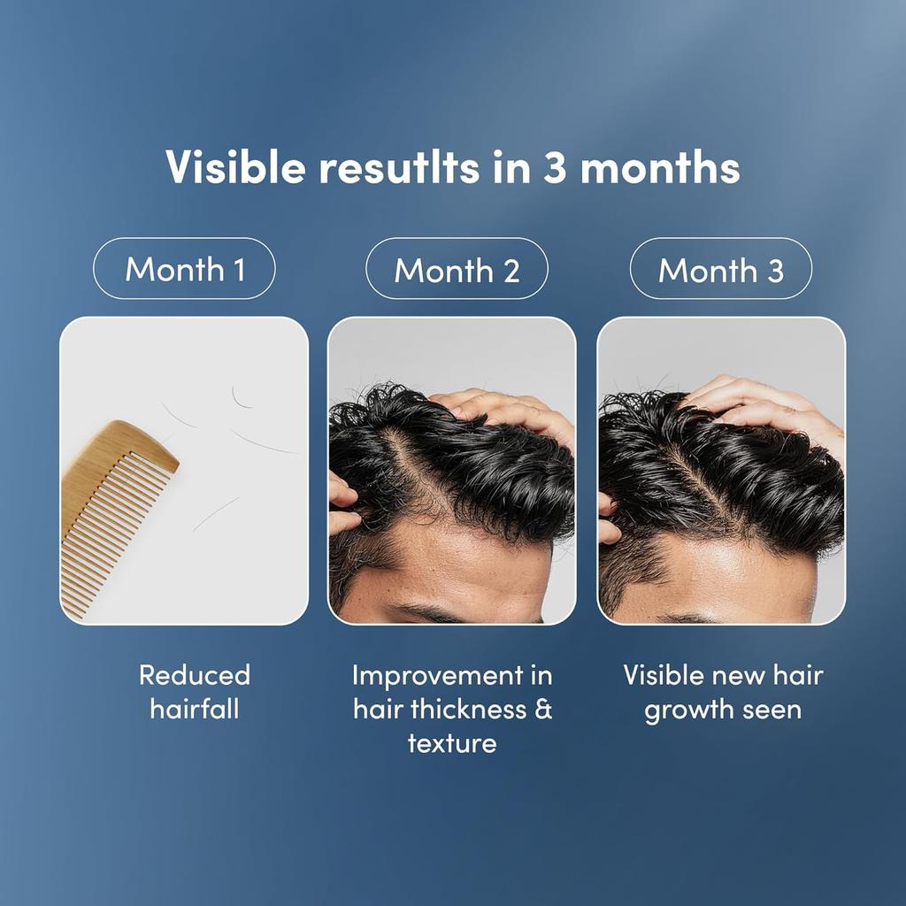 Man Matters Advanced Hair Serum 30ml Pack of 1 | Redensyl Anagain Aminexil Hair Growth & Density Booster