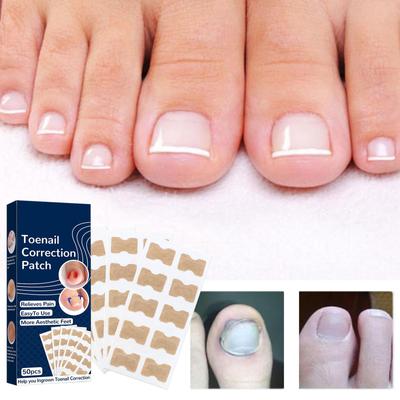 Strumenti per pedicure dell'unghia del piede Correttore per raddrizzamento fisico Correzione elastica Patch di correzione Patch adesiva Clip