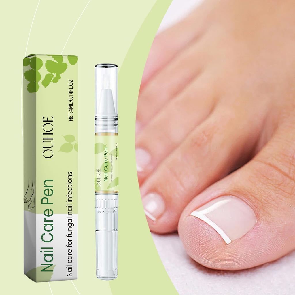 Ouhoe Nagelpflege-Stift zur Pflege und Stärkung empfindlicher Nägel und Nagelhaut