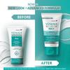 Dr. Reddy’s Venusia Max For Dry Skin With Shea Butter & Cocoa Butter - Pack of 2x150g Intensive Moisturizing Cream