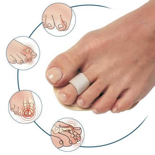 Single Toe Straightener ()