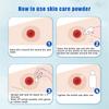 Skin Care Flour Dry Flour Stoma Treatment Medical For Tool Ostomy Accessory Colostomy Bag Supply Protective Care Products