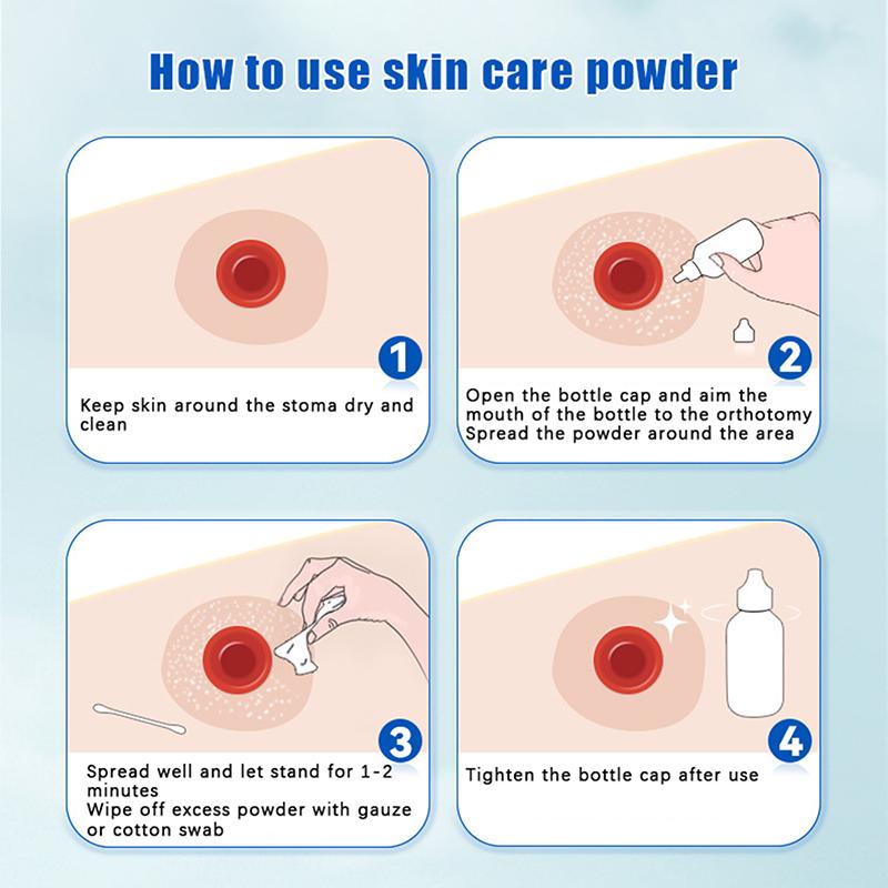 Skin Care Flour Dry Flour Stoma Treatment Medical For Tool Ostomy Accessory Colostomy Bag Supply Protective Care Products