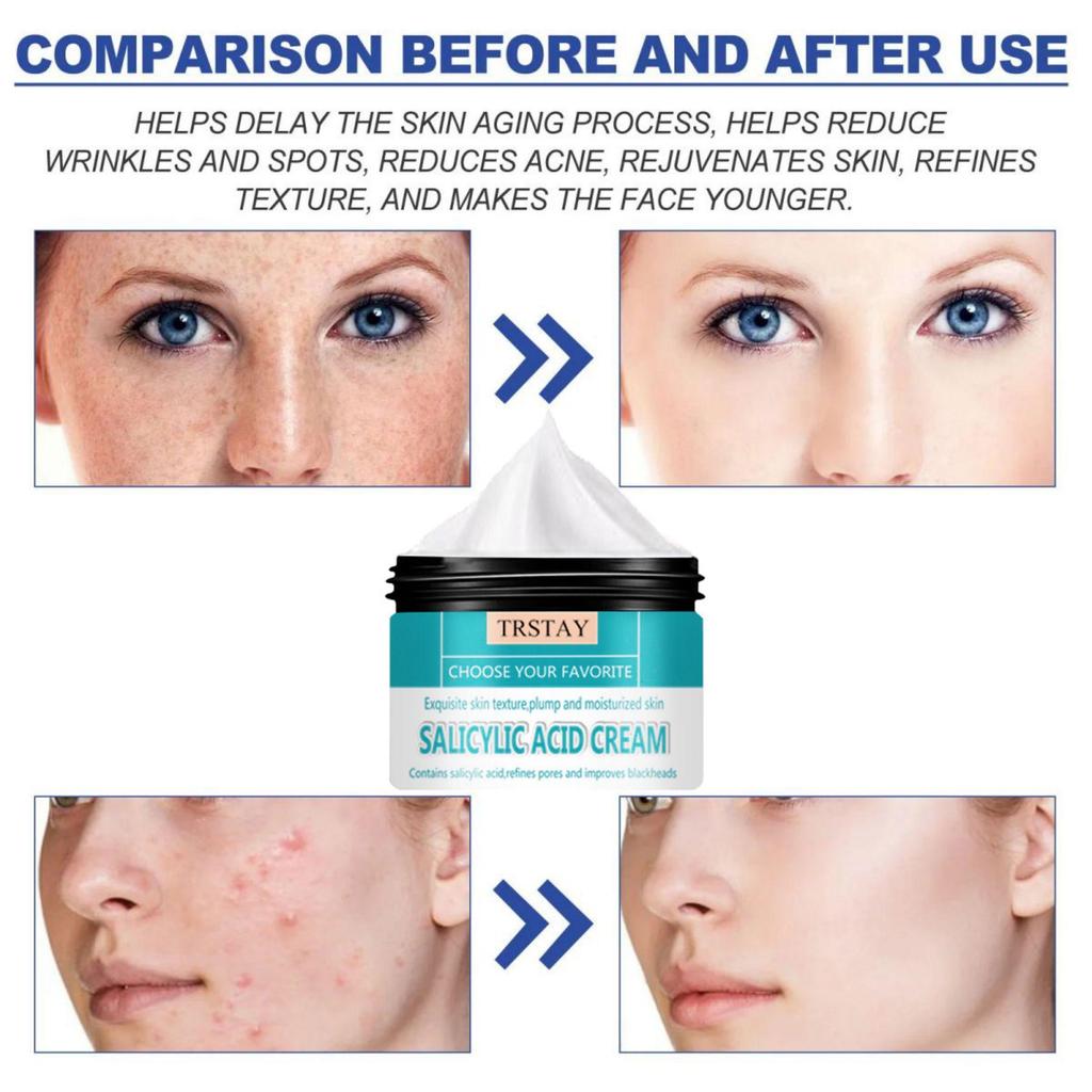 Krém na obličej, Retinolový krém na obličej, vrásky, jemné linky a hyperpigmentaci, Retinolový noční krém s acetylhexapeptidem-8 a kyselinou hyaluronovou