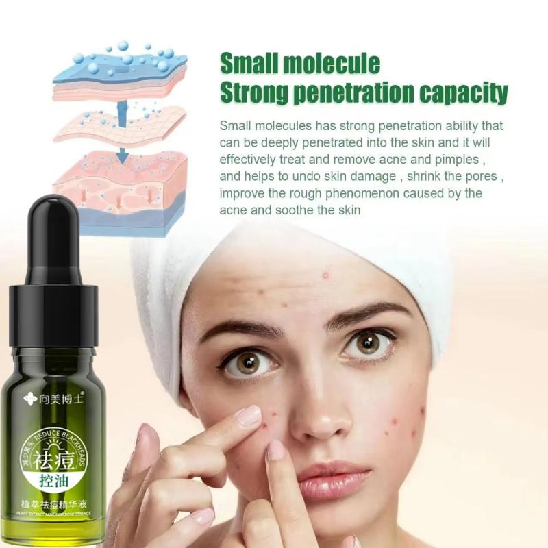 Plant Extract Acne Removal Cream Anti-Acne Repair Redness Pimple Spots Deep Cleaning Pore Oil Control Moisturizing Skin Care