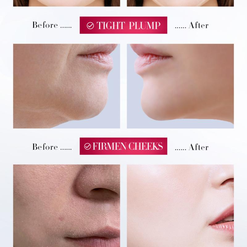 V Face Firming Cream 30gSADOER Facial Lift Firming Skin Facial Cream