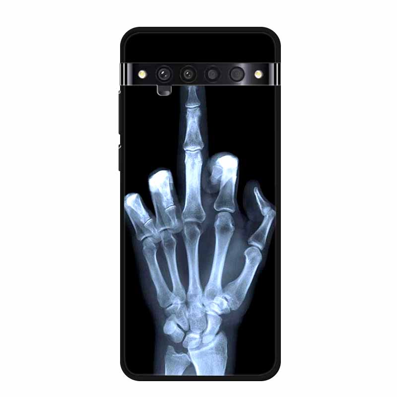 Für TCL 10 Pro Hüllen Weiches TPU Silikon Katze Löwe Rückseitenhüllen für TCL 10 Pro T799B T799H Cover Stoßfest Funda Capa TCL10Pro 6,47"