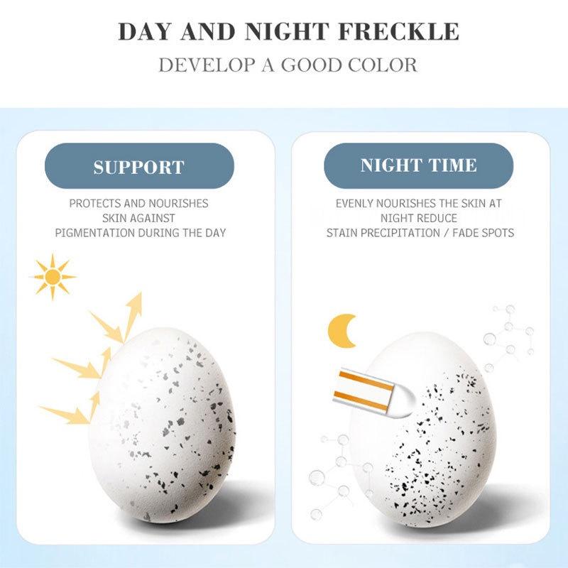 Whitening Freckle Cream Effective Remove Dark Spots Anti Freckle Cream Fade Pigmentation Melasma Brighten Cream