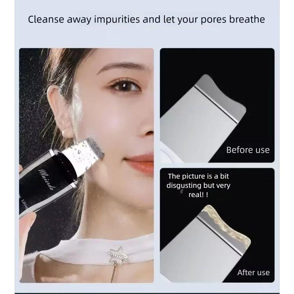Acne Removal Vibration Beauty Device Facial Cleansing Blackhead Scraper Face Care