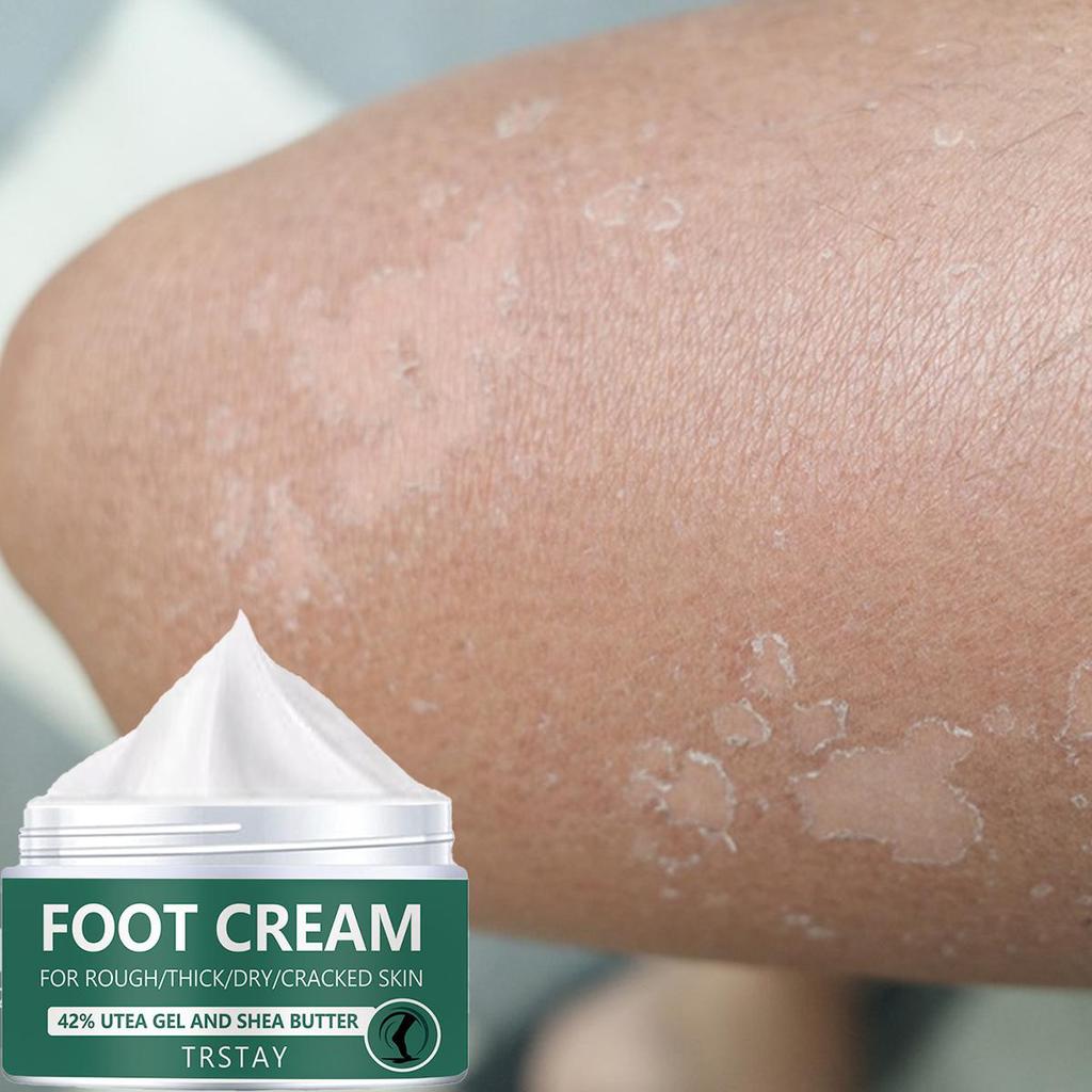 Creme para os pés, rachaduras no calcanhar para remover pele morta, máscara esfoliante seca para cuidados com a pele, pele suave e não irritante