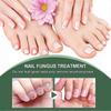 Extrem starke Nagelpilzbehandlung, beste Nagelreparatur Stoppt Pilzwachstum Effektiv