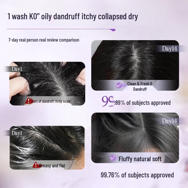 Vetes Rosemary Anti-Dandruff Shampoo