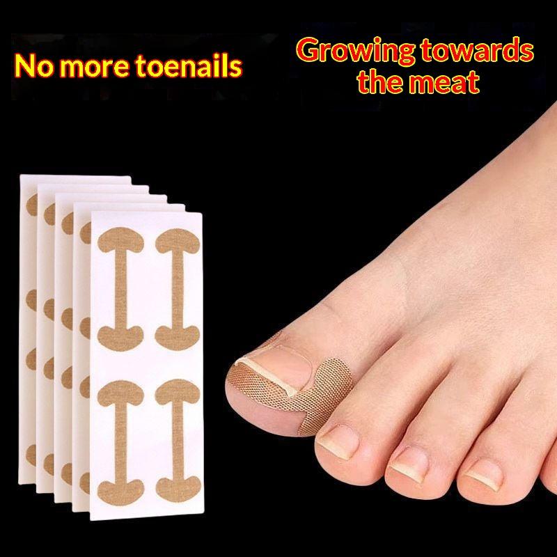 10/30/50 Sheets Ingrown Toe Nail Correction Sticker Adhesive Toenail Patch Foot Corrector Pedicure Health Care Tools