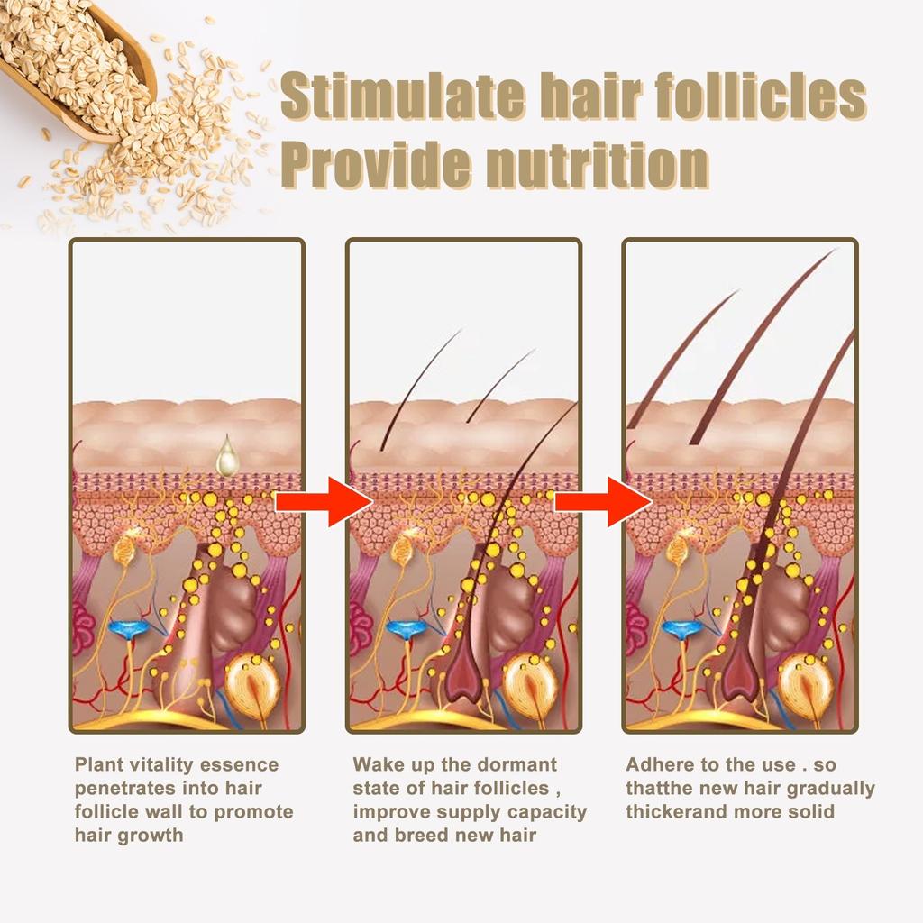 Invigorating Oat & Rice Shampoo Bar, Anti-Hair Loss Rice Shampoo Bar, Moisturizing Shampoo Stick, Rice Shampoo Bars For Hair Growth