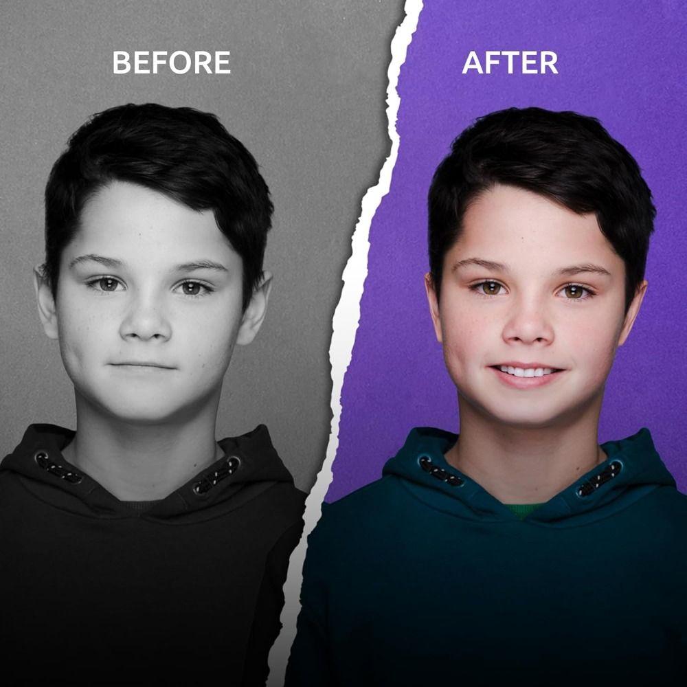 Transparent Ear Correctors Behind Ear Adhesive Ear Corrector Hot Ear Tape for All Ages Women Men