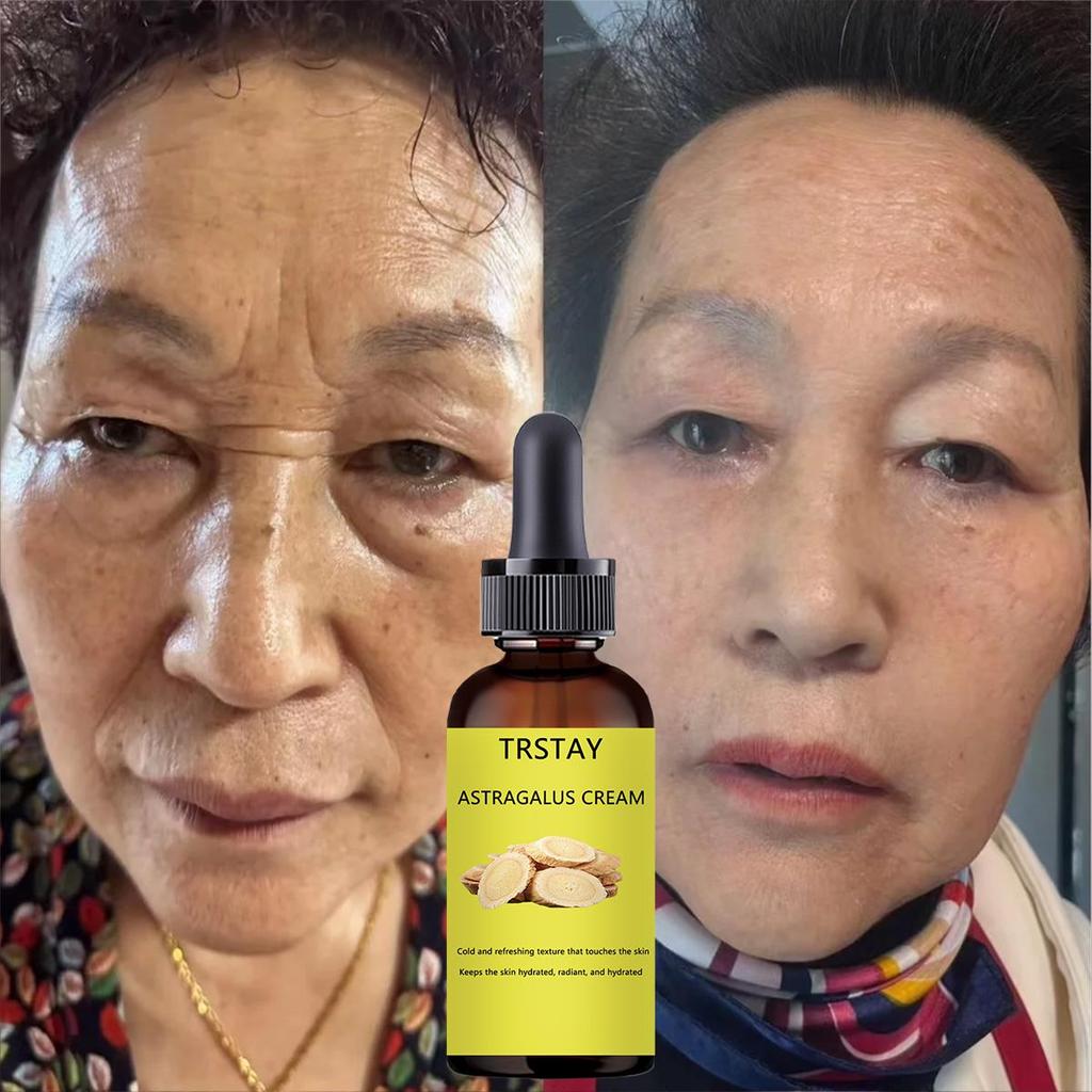 Botoxup Face Cream, Tightens, Moisturizes Skin Face Cream, Restore Youthful And Smooth Skin