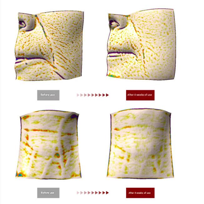 CENTELLIAN24 Madeca Krem Time Reverse 50ml 3szt