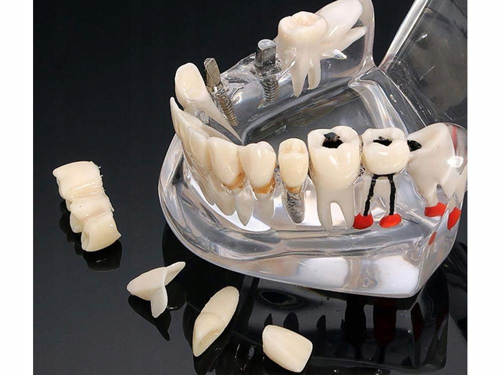 Dental Model 2 White (100) Gab_B