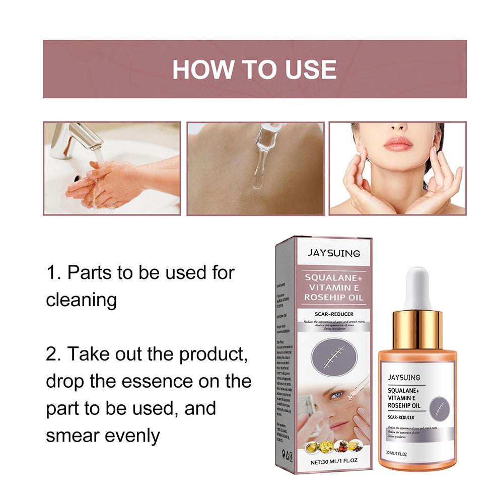 Scar Surgery Scar Dilution Cream To Burn The Impression Scar Dilution Surgery Beard Cream Remov I3U7