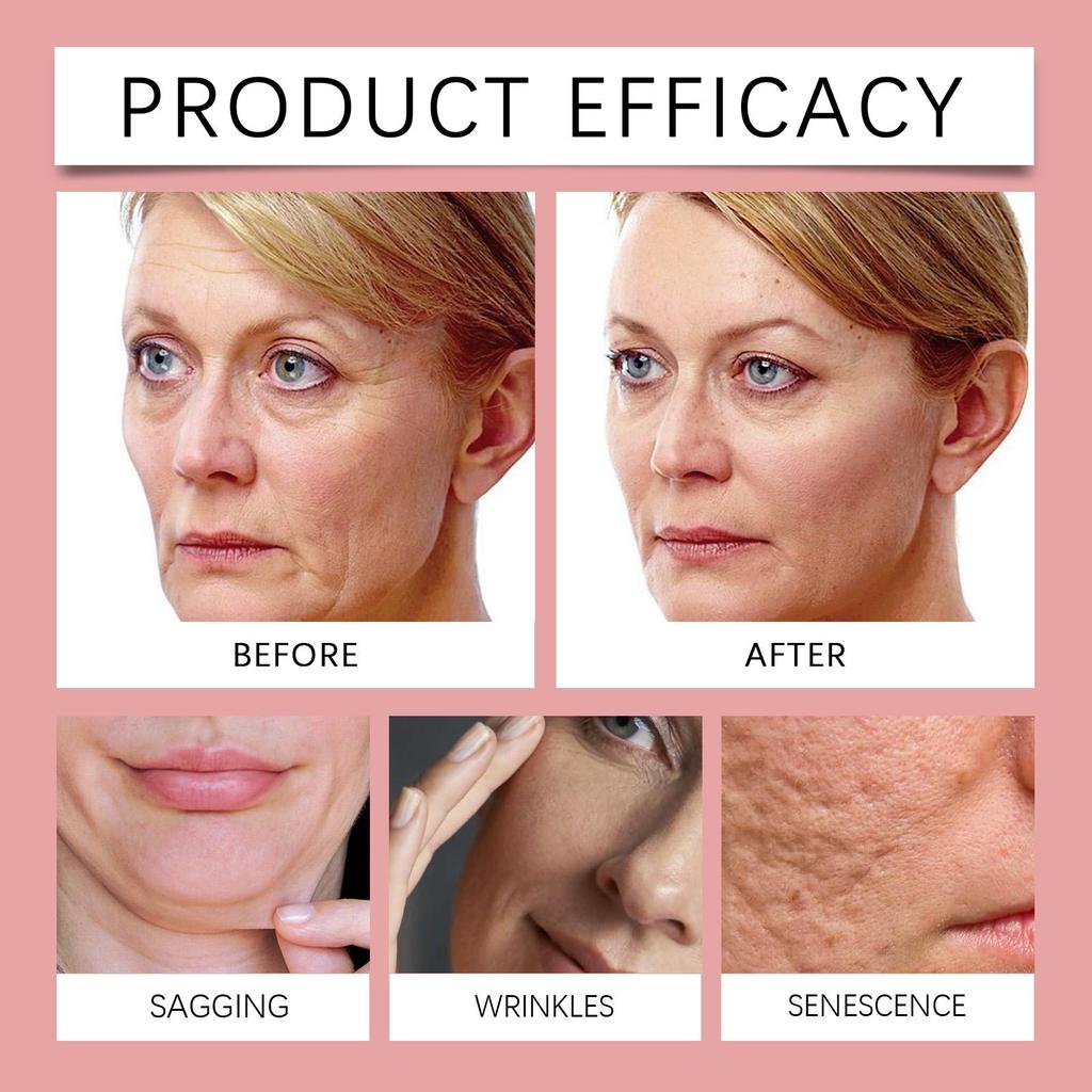 Hoygi Crema al Collagene 50g - Crema viso delicata, antirughe, antietà, profondamente idratante, lenitiva e nutriente.