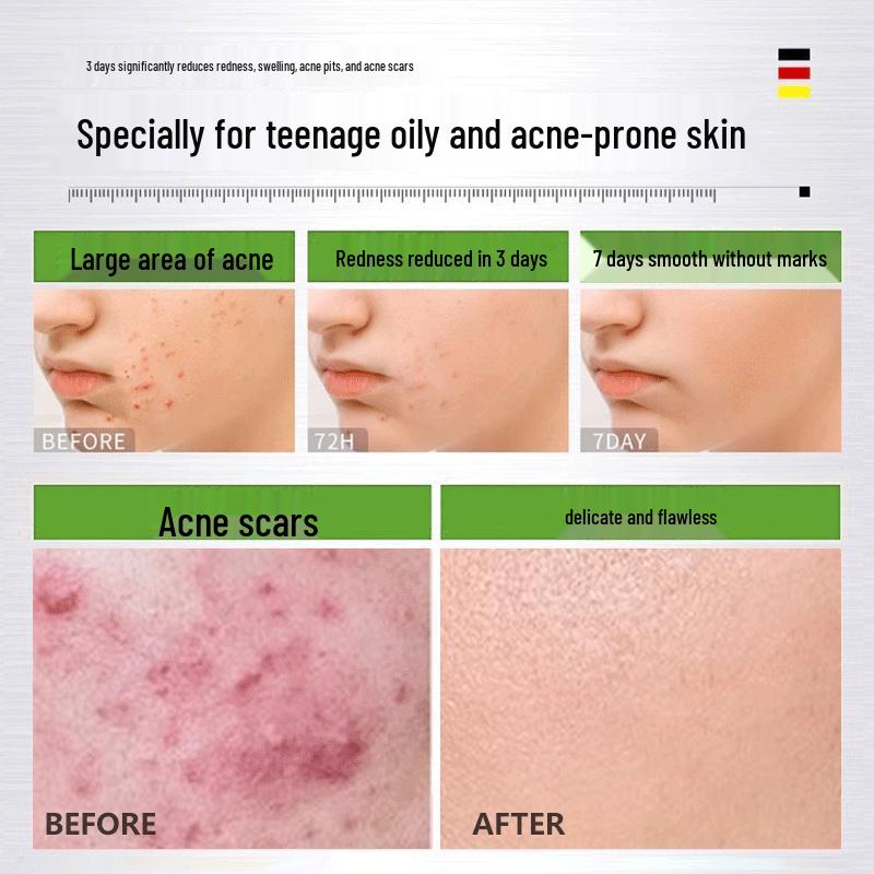 Qingyan Amino Acid Camellia Foaming Cleansing Mousse 600g