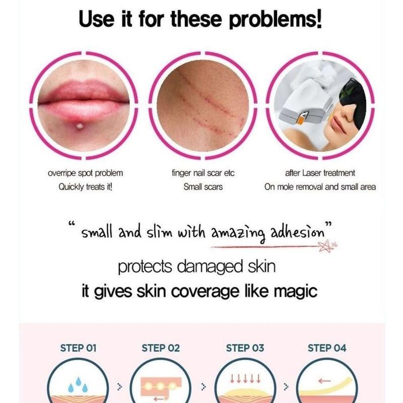 TOSOWOONG - SOS Repair Cica Clinic Acne Patch 66pcs