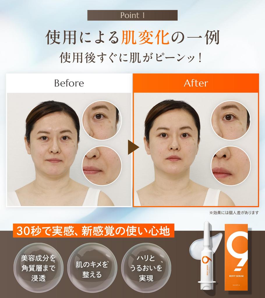 in See results in 30 seconds Exosome wrinkle improvement cream serum RepitSerum 4 million units sold PDRN Spicule Korean cosmetics care 6ml RepitSerum