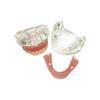 Modelo de Implante Dental 2 Implante Prótesis Completa Superior Inferior Modelo de Dientes Typodont Productos de Odontología Para Enseñanza Estudio