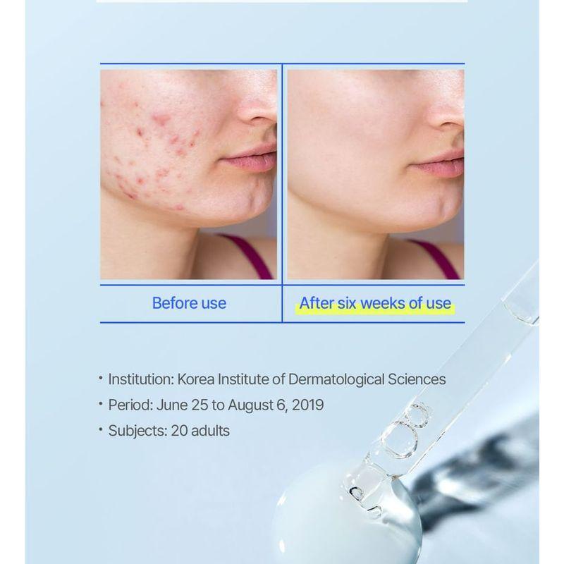 THE FACE SHOP - Dr. Belmeur Clarifying Spot Care Ampoule
