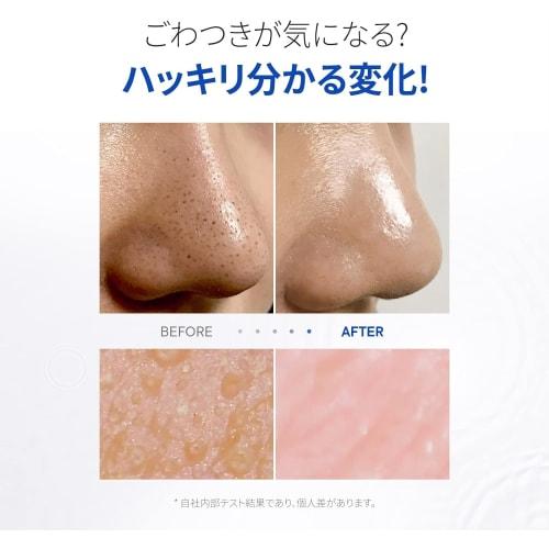 [One-day's you] One Day's You P.Z. SSOC SSOC No More Blackhead Removal Pore Clean Duo 100ml  Sebum Care Blackheads P.Z SSOC SSOC NO MORE BLACKHEAD [Of