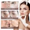 Spots Peel Off Facial Mask Freckle Pigmentation Removal Cream Chloasma Care Dark Spot Correction Glow Whiten Peeling Mask Strong