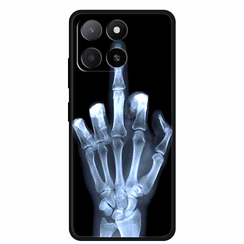 Für ZTE Blade A55 A35 Hülle Tiere Weiches Silikon TPU Handyhüllen Rückseite für ZTE Blade A35 BladeA55 Wolf Stoßfest Cool Capa