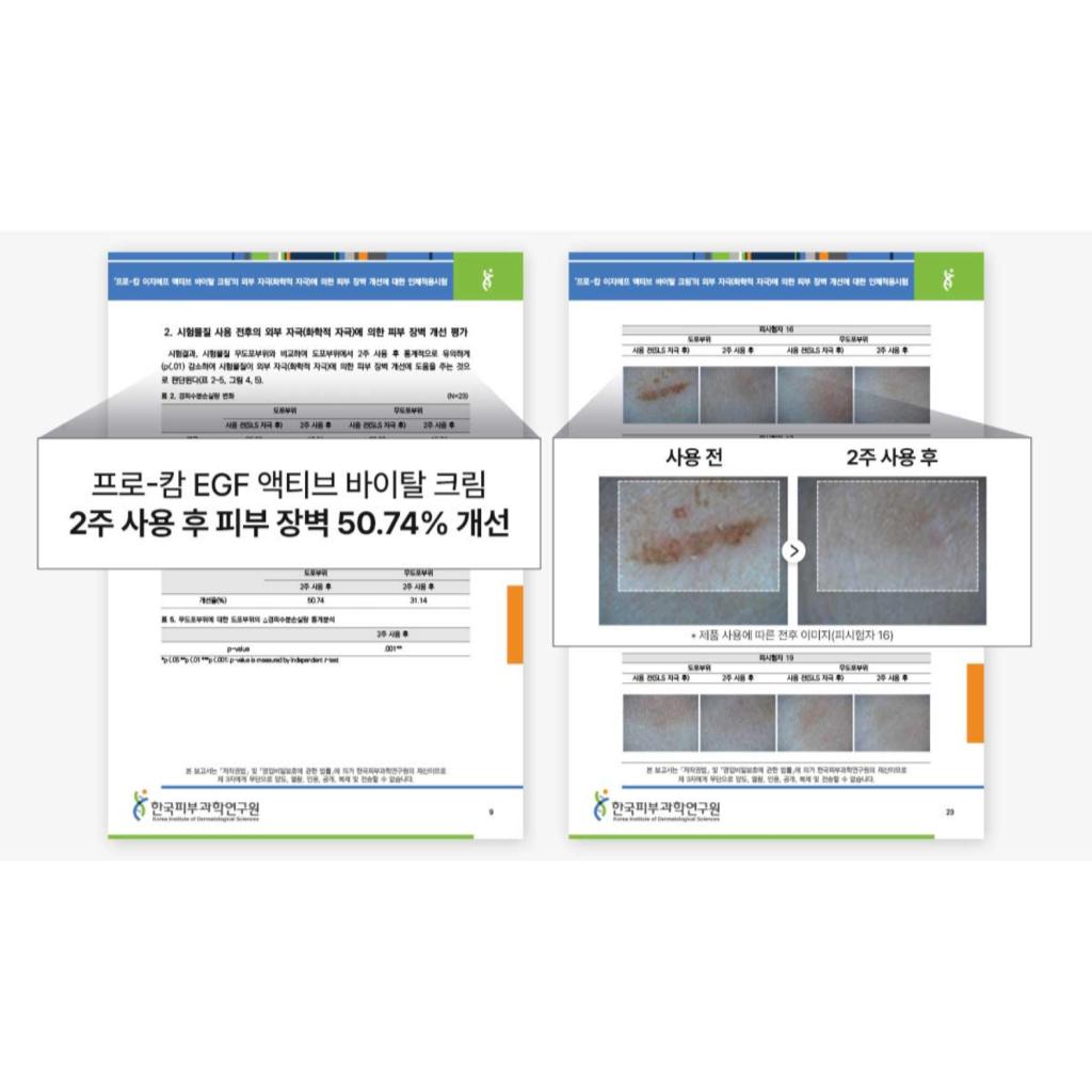 [Hanmi Pro-Calm] EGF Active Vital Cream
