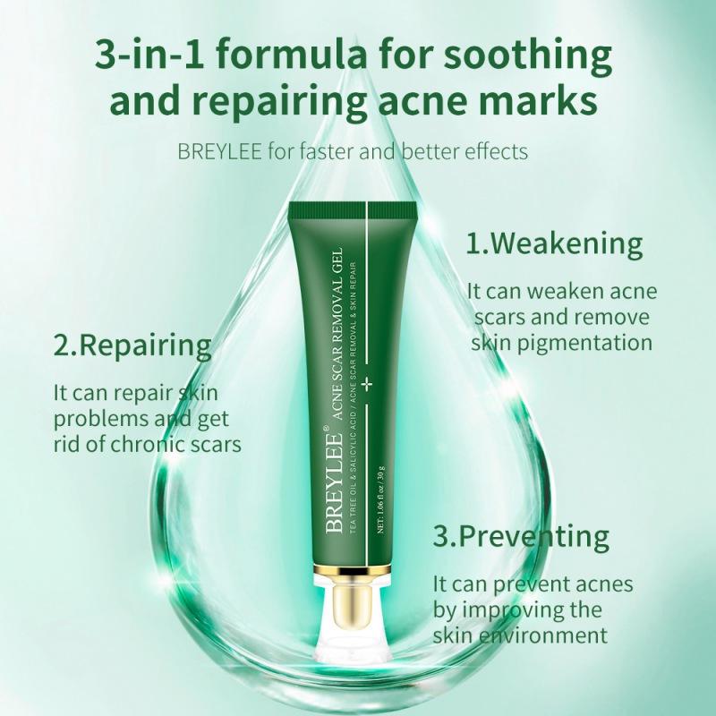 serum for acne pigmentation