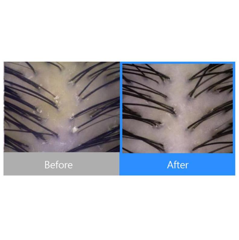 MED:ALL Hair Loss Care Nutrition Essence 120ml – Scalp Strengthening Treatment