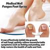 Medical Nail Fungus Foot Spray, Herbal Care Medical Grade Nail Foot Spray, Foot Fungus Treatment Spray Nail Repair Spray