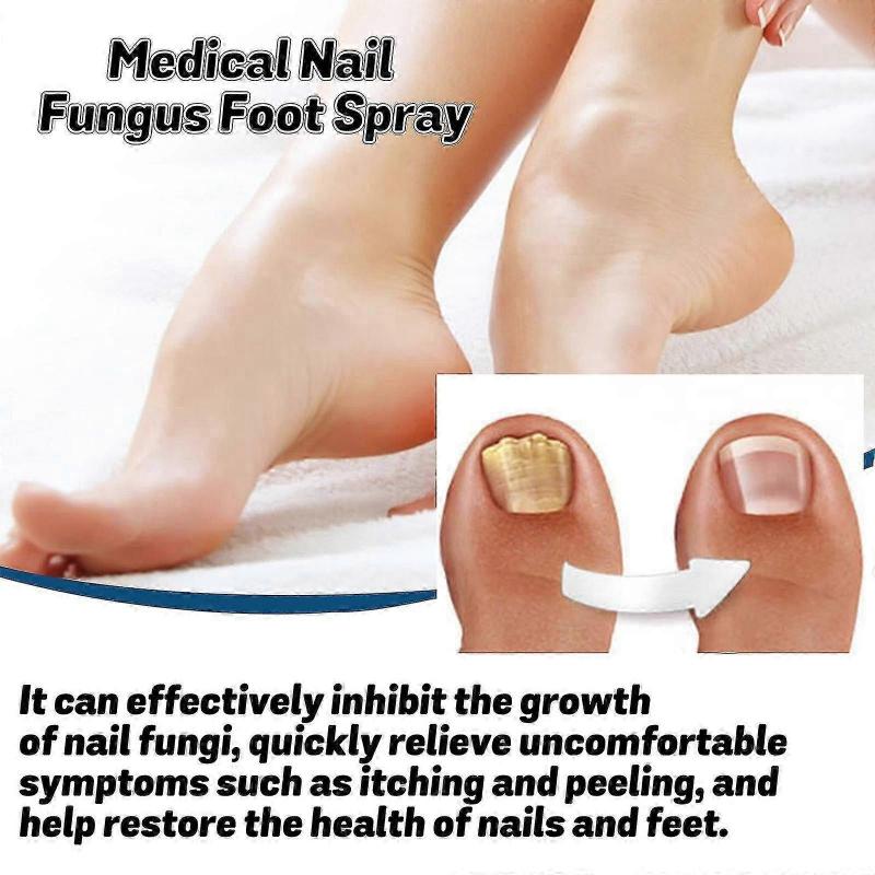Medical Nail Fungus Foot Spray, Herbal Care Medical Grade Nail Foot Spray, Foot Fungus Treatment Spray Nail Repair Spray
