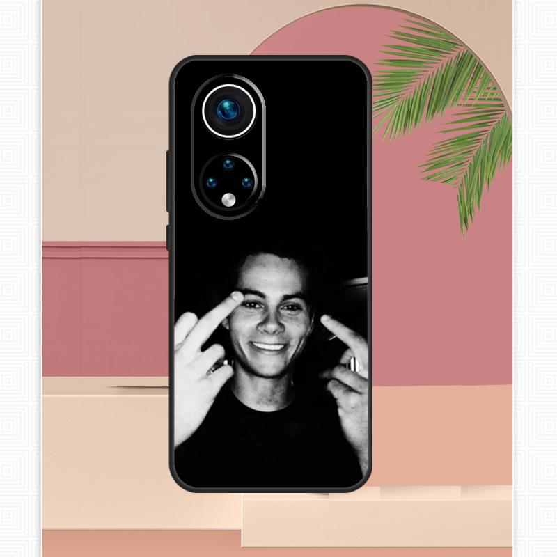 Dylan O'Brien Teen Wolf Case For Honor Magic 5 6 7 8 Pro Honor X9c X9b X9a X8b X8a X8c 50 70 90 400 200 Lite Cover