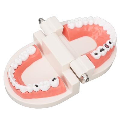 Zahnerkrankung Karies Zähne Modell Harz Simulation Lehr-Requisite Zahnmodell für Patienten Studenten Bildung