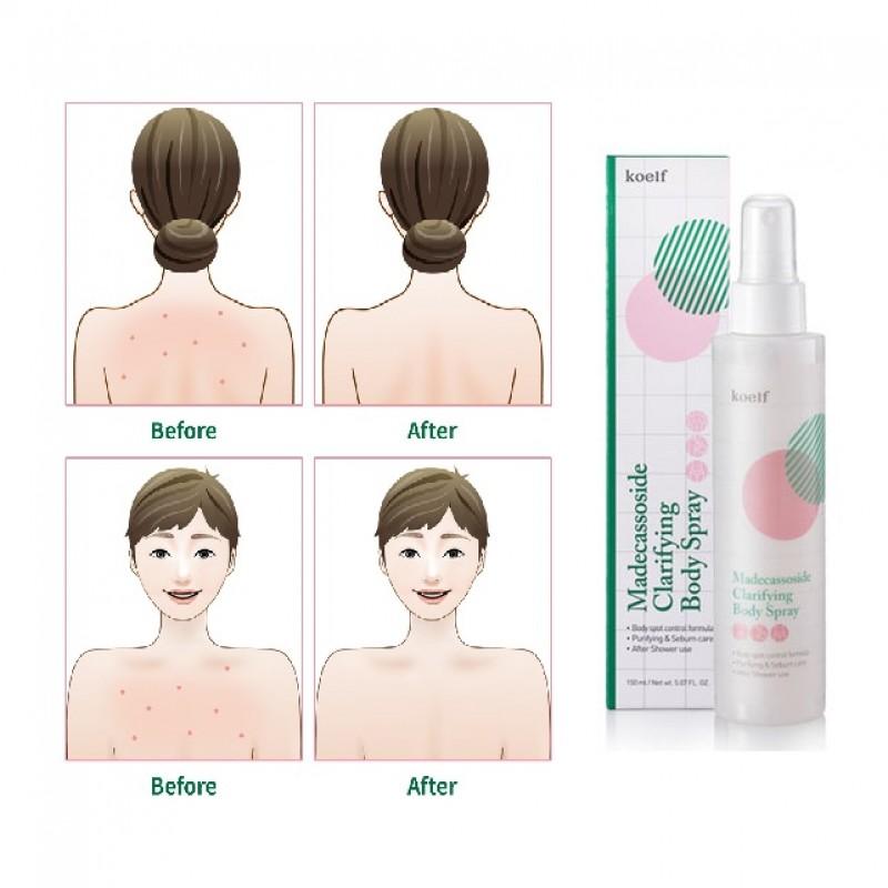 

Petitfee Koelf Madecassoside Clarifying Body Spray 150ml AUTHENTIC STORE