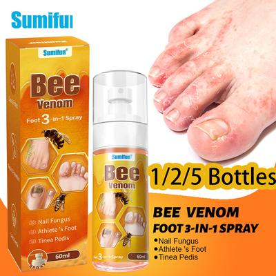 60/120/300ML Sprej pro péči o chodidla včelí úl Ulevuje beriberi, zápachu nohou, nehtové antibakteriální onychomykóze, regenerační sprej, letní nezbytnost