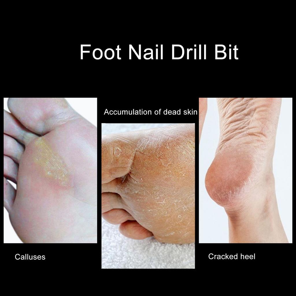 Stainless Steel Round Foot Nail Drill Bit Pedicure Foot Calluses Sanding Polishing Head for Cracked Skin Corns