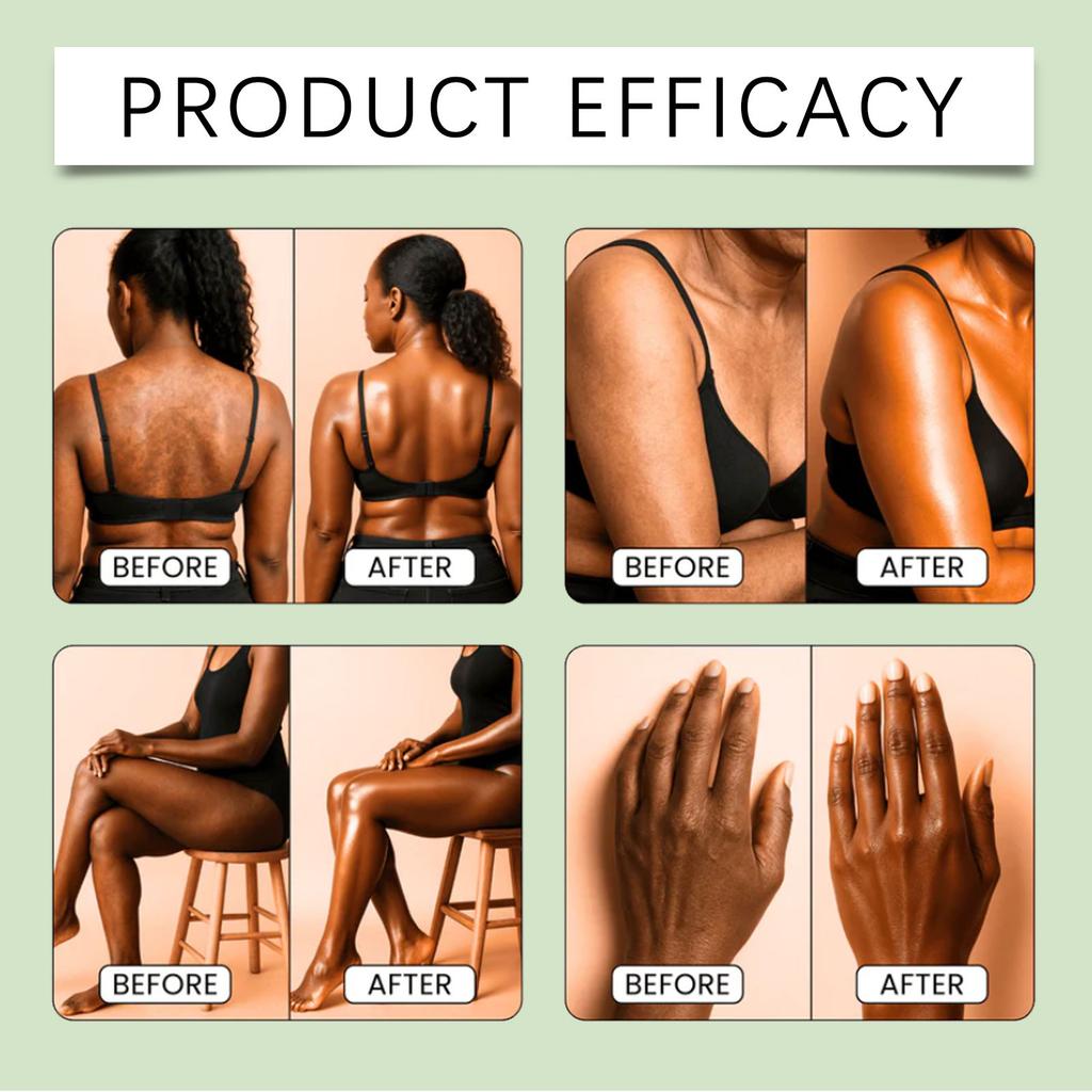 Hydratační a rozjasňující krém na tělo je vhodný pro každodenní péči o intimní partie, podpaží, kolena a lokty.