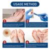 1/6/10/50/100PCS Foot Care Sticker Medical Patch Corn Removal Pads Curative Patches Calluses Remove Callosity Detox Summer Foot Care Tools