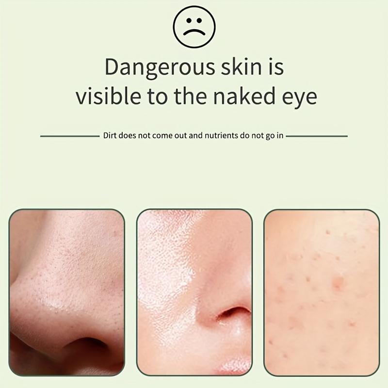 Portable Manual Blackhead Remover Tool for Facial Skincare, Pore Cleaning and Tightening