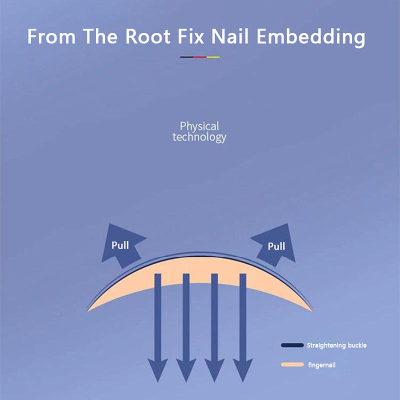 Werkzeuge zur Korrektur eingewachsener Zehennägel, Pediküre, Wiederherstellung, eingebettete Zehennagelbehandlung, professionelles Fußpflegetool zur Korrektur eingewachsener Zehennägel